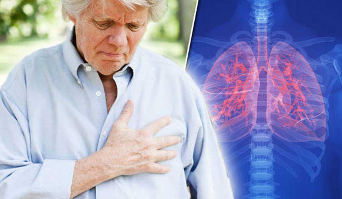 مرض سرطان الرئة الأعراض والأسباب والتشخيص ووسائل العلاج والوقاية