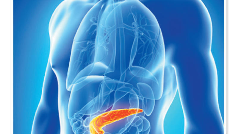 مرض سرطان البنكرياس ما هي أعراضه وأسبابه وما هي طرق العلاج والوقاية؟