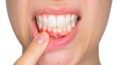 اسباب نزيف اللثه أهم اسباب التهاب ونزيف اللثه وطرق علاجه